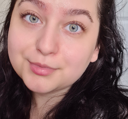 "Skin isn't meant to be perfect" - Meet Alice