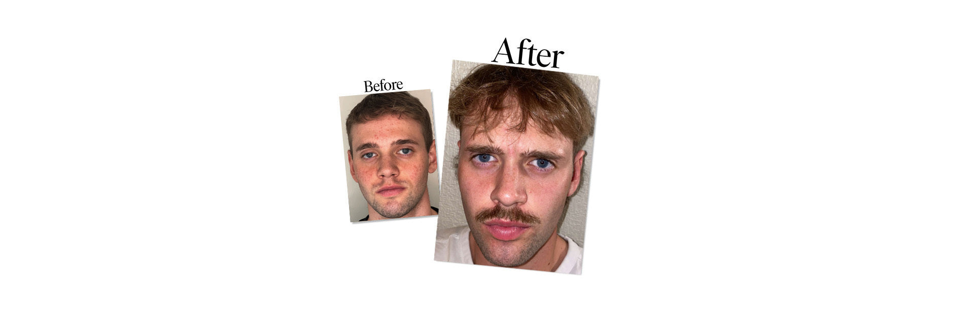 Sid, Soccer Player - Real Skin Stories