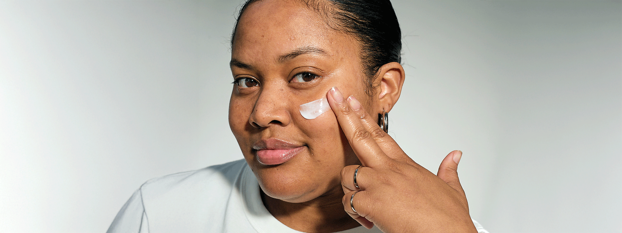 melanotan scarring White Scar Treatment How Melanin Affects Scarring (And