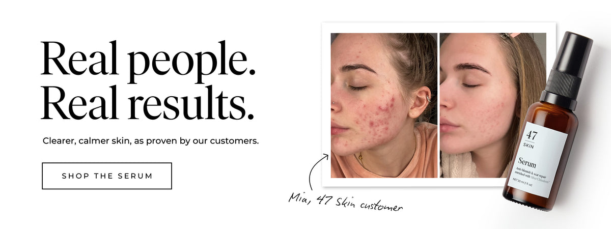 Real People, Real Results. Shop the Serum.