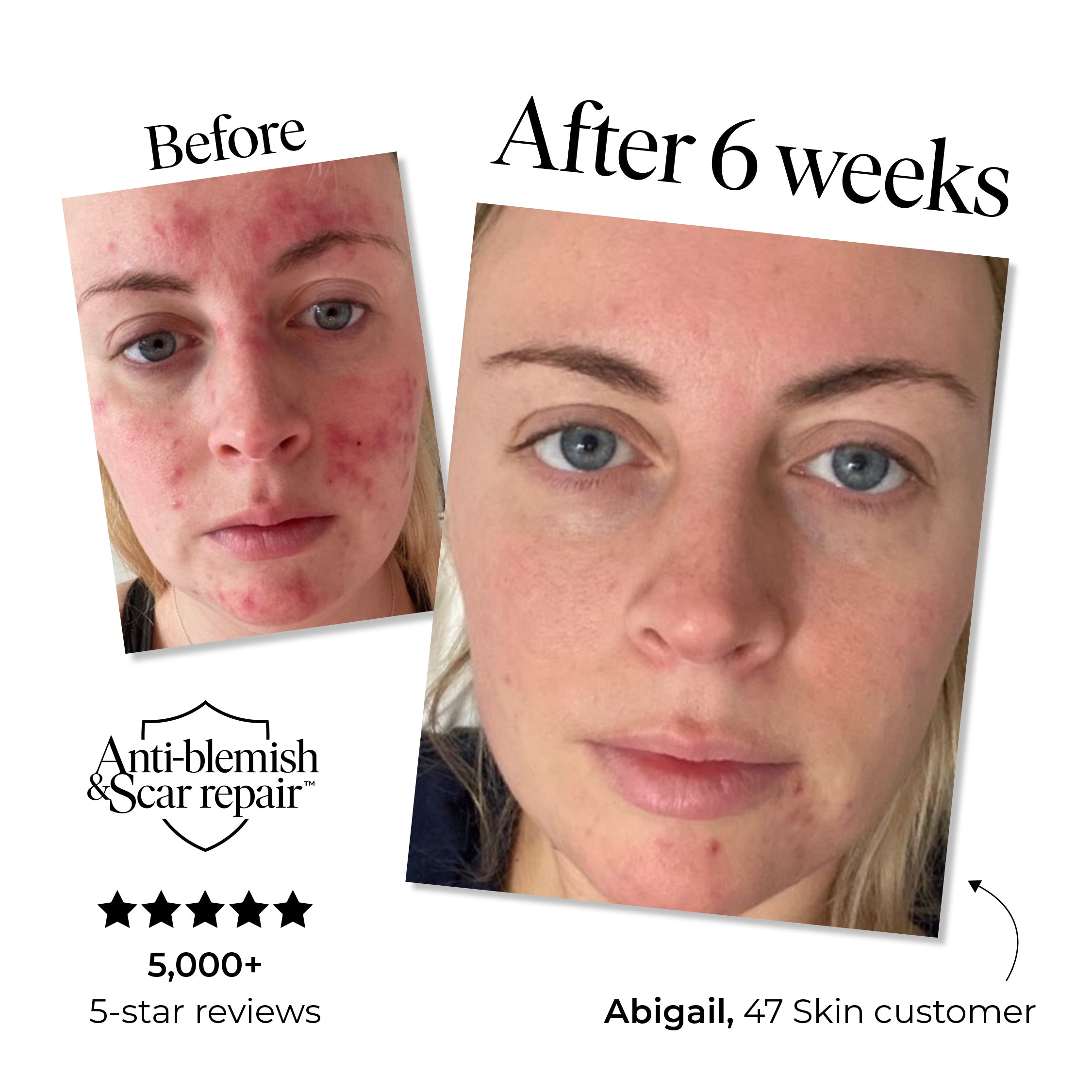 4 Step Skin Repair Set