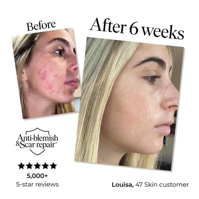 Anti-Blemish & Scar Repair Blue Clay Mask