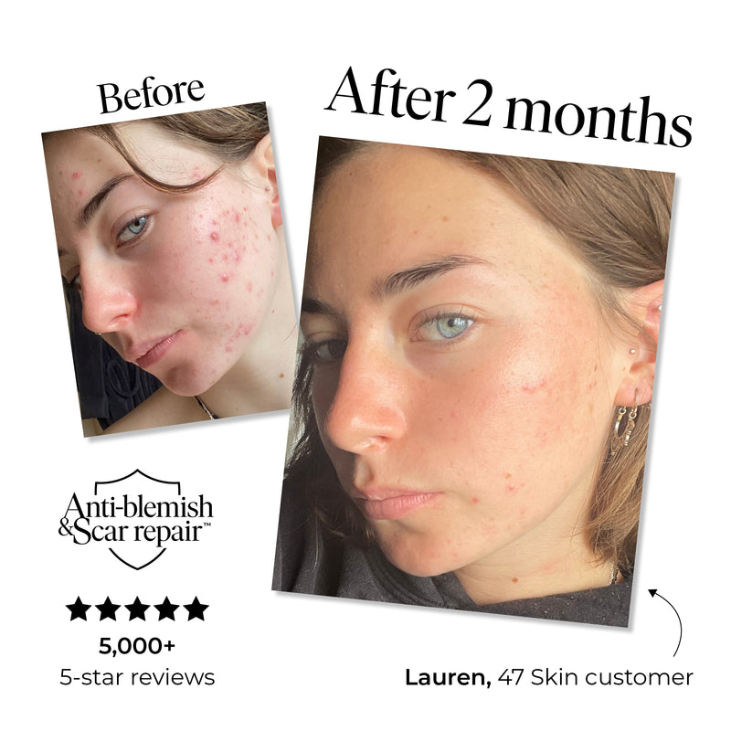 Daily SPF 30, enriched with Silver Chitoderm