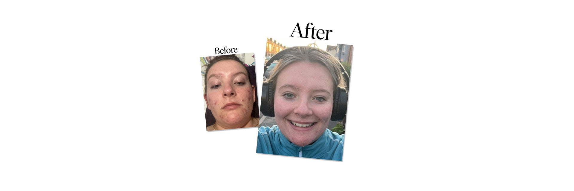 Bella, Cricket Player - Real Skin Stories