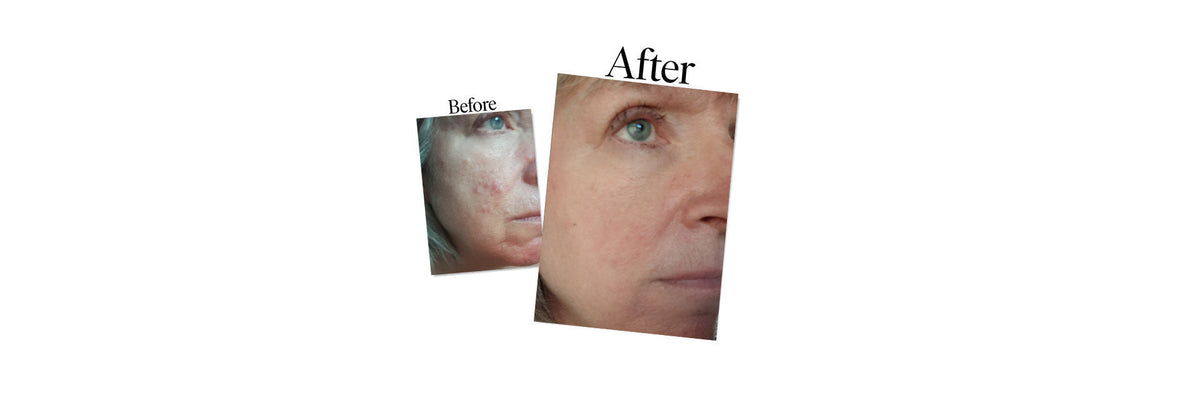 Menopause and your skin: what changes and how to care for it.