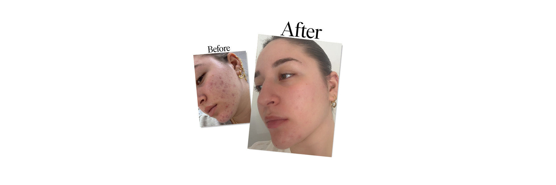 Maddie, Makeup Artist - Real Skin Stories