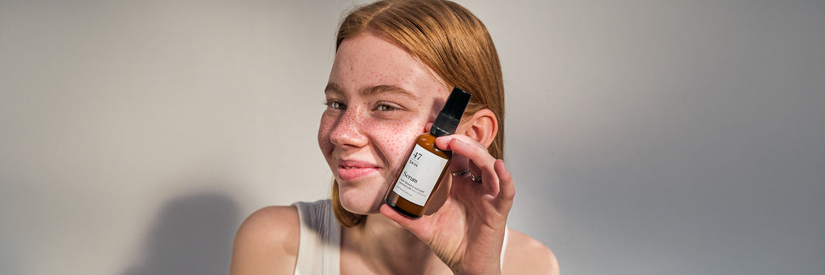 SPF for Blemish-Prone Skin: Why It Matters More Than You Think