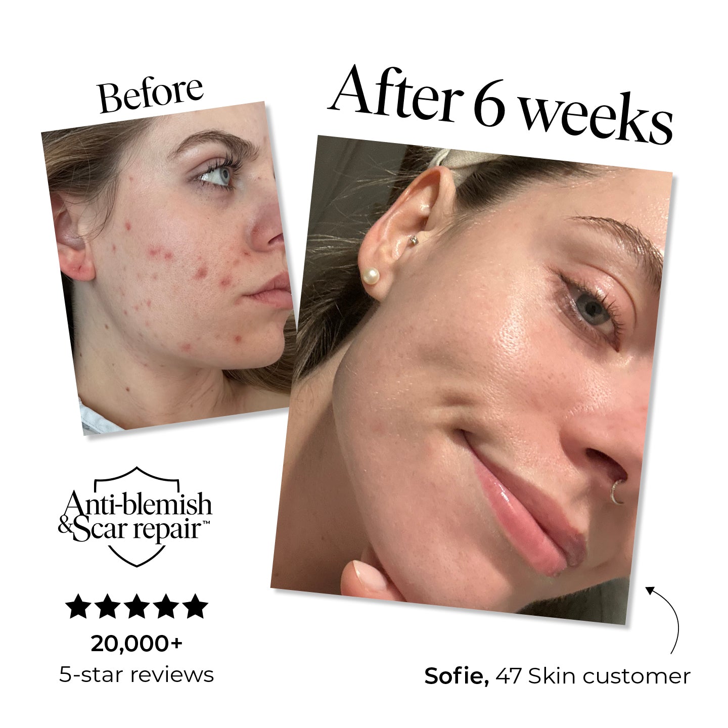 3 Step Moisture Set