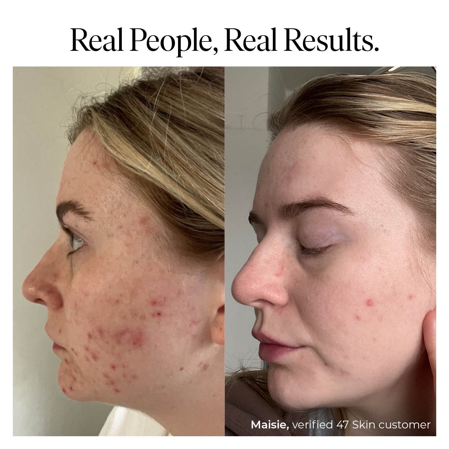 Anti-Blemish & Scar Repair Blue Clay Mask