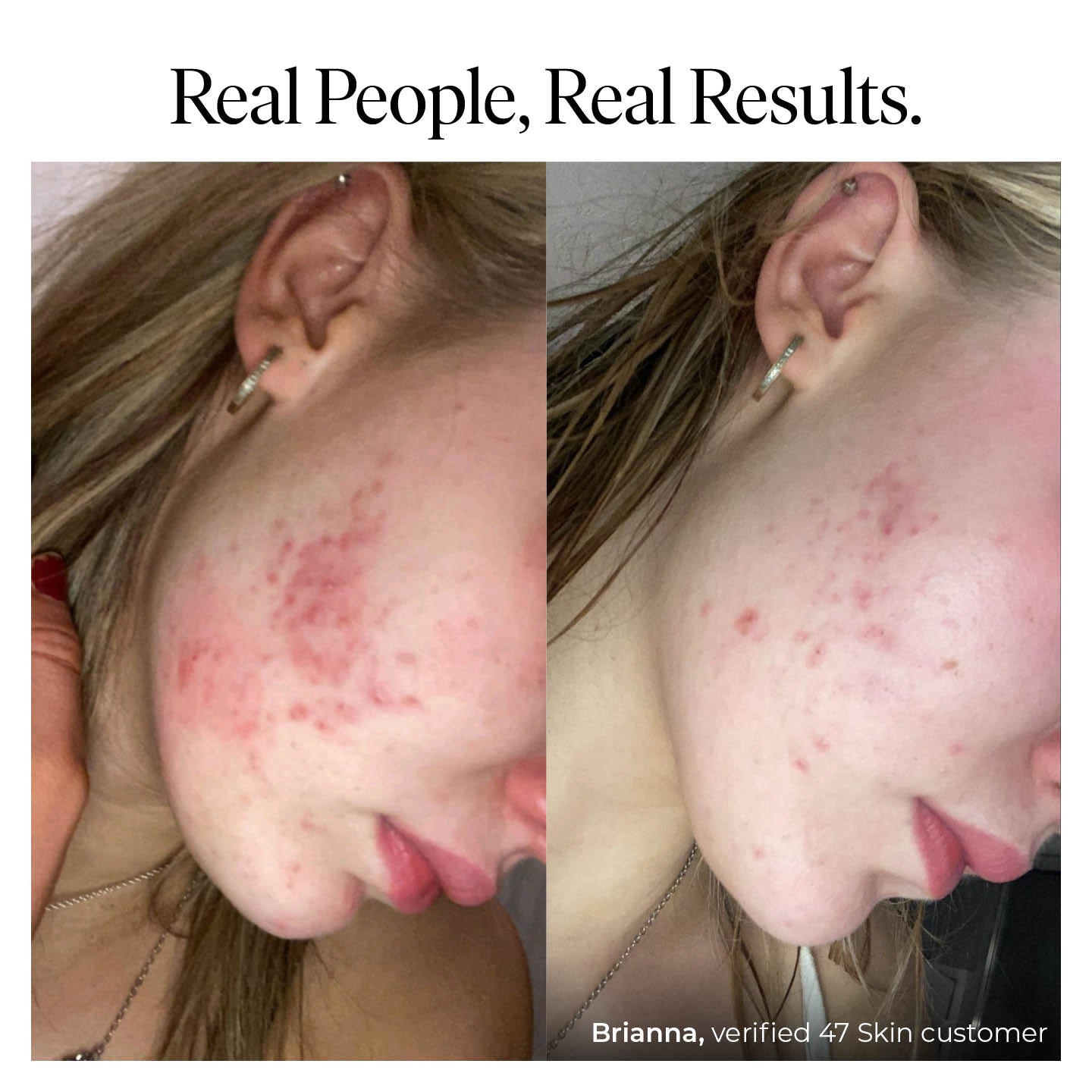 Anti-Blemish & Scar Repair Blue Clay Mask