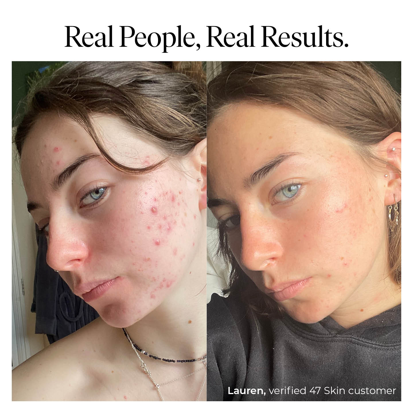 Daily SPF 30, enriched with Silver Chitoderm