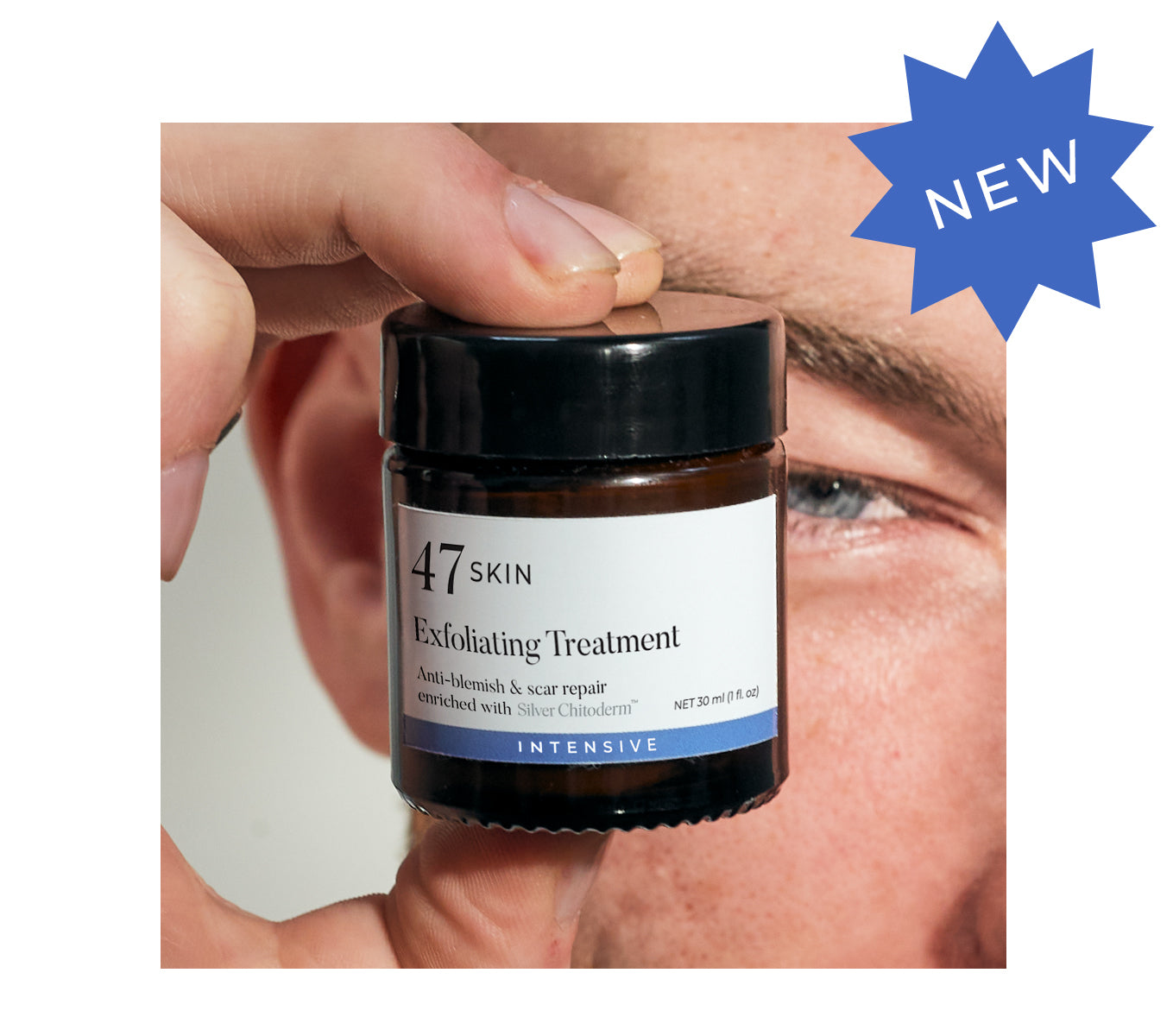 Exfoliating Skin Treatment for persistent, stubborn and cystic acne.