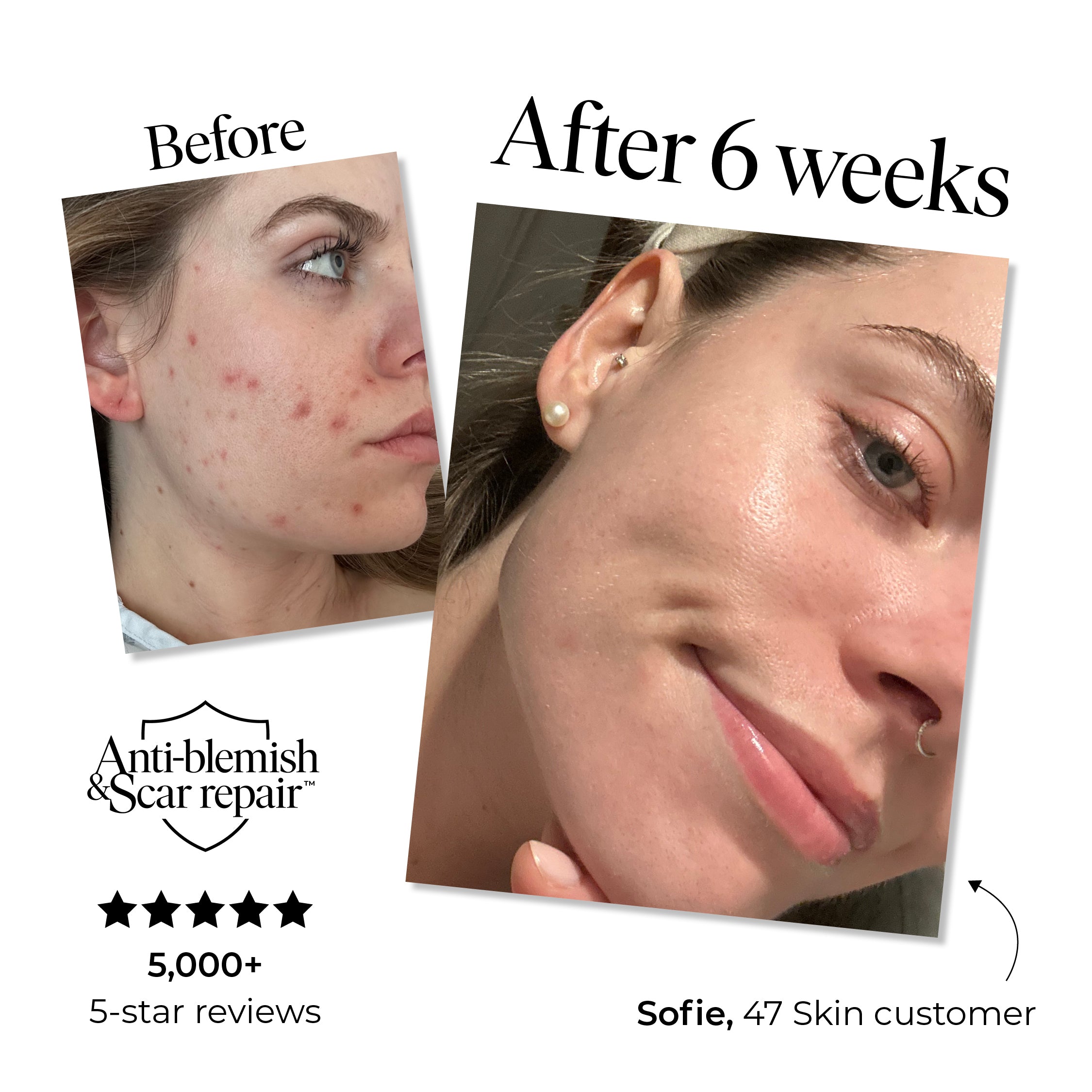 3 Step Moisture Set