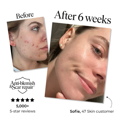 3 Step Moisture Set