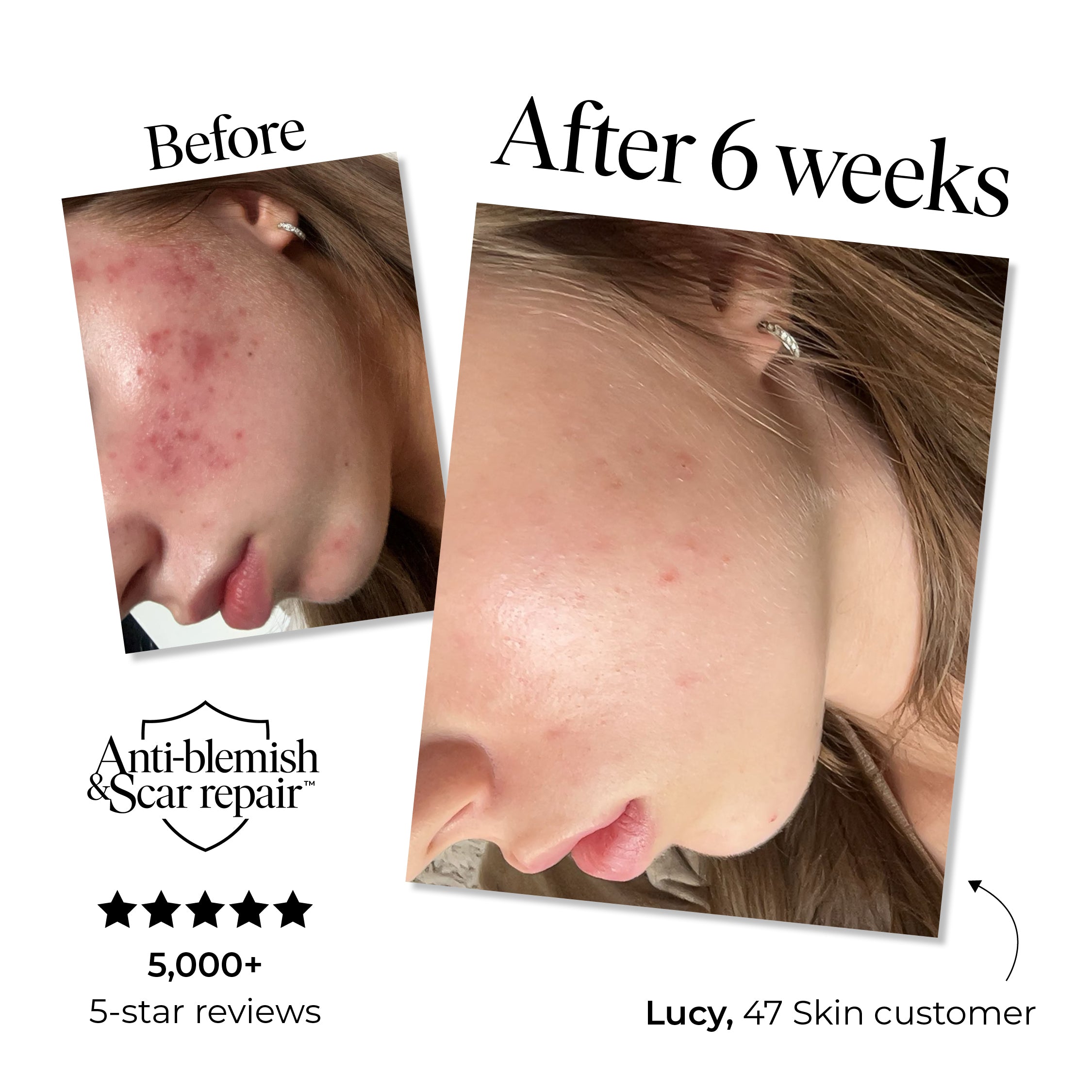 3 Step Treatment Set