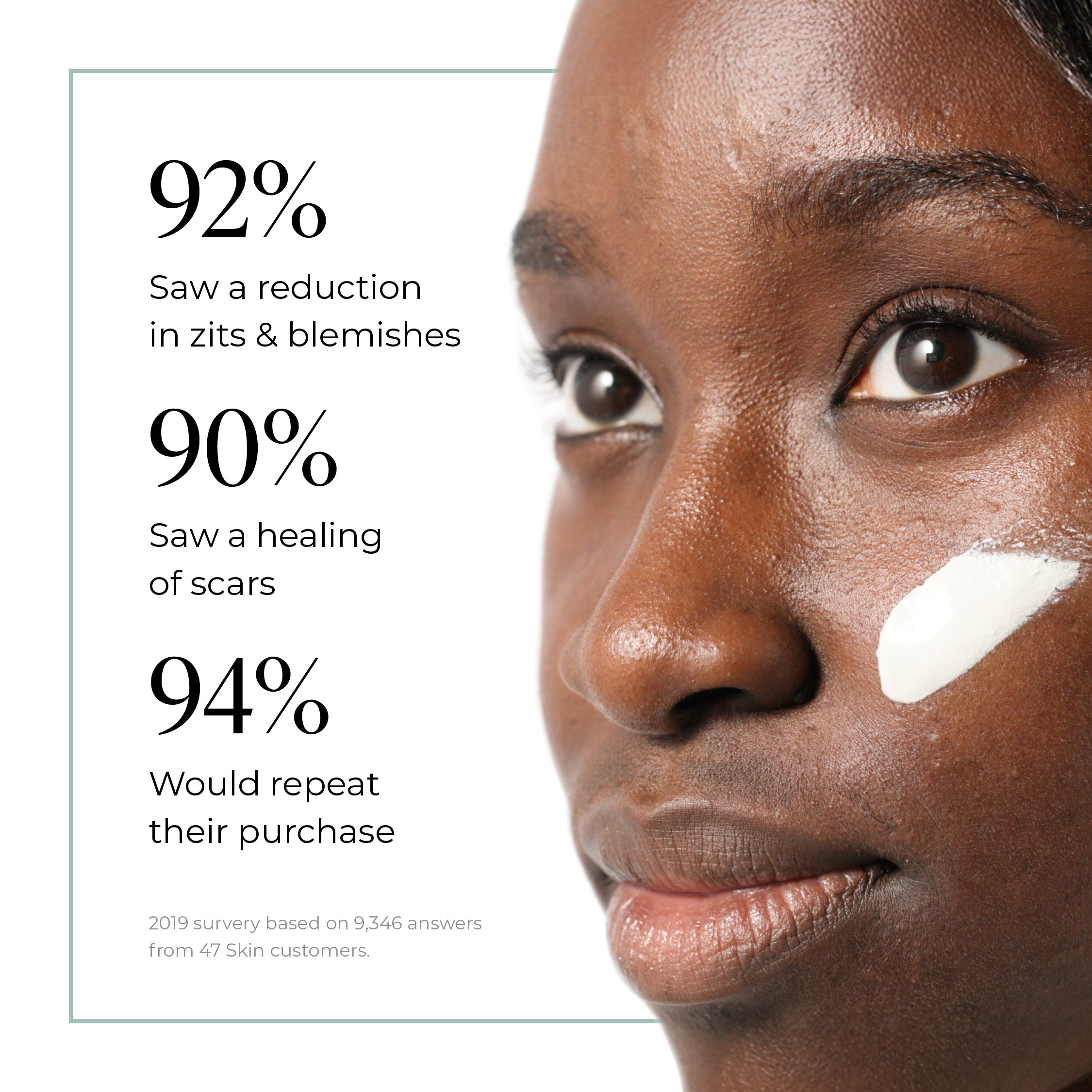 Exfoliating Skin Treatment for persistent, stubborn and cystic blemishes