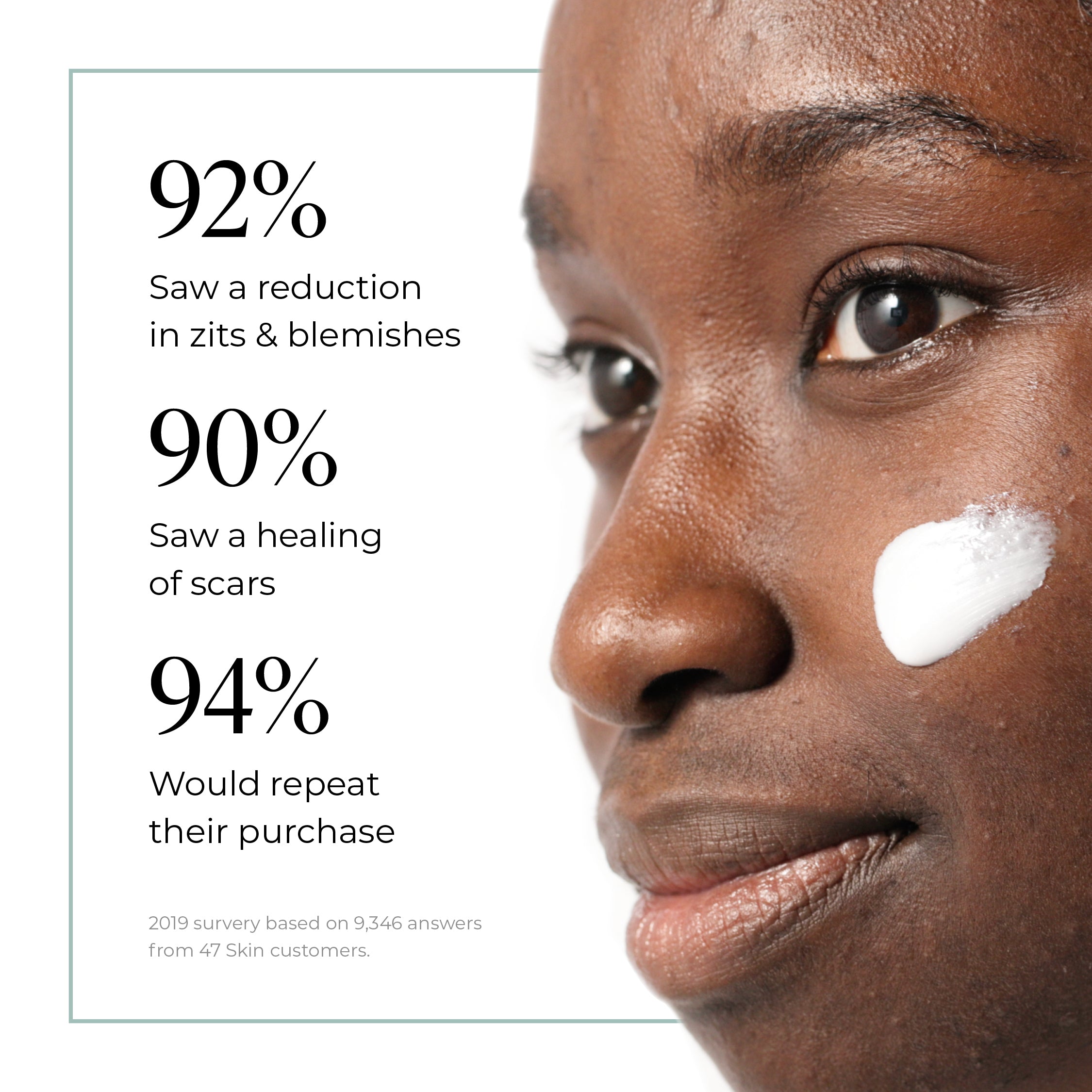 Anti-Blemish and Scar Repair Silver Mask