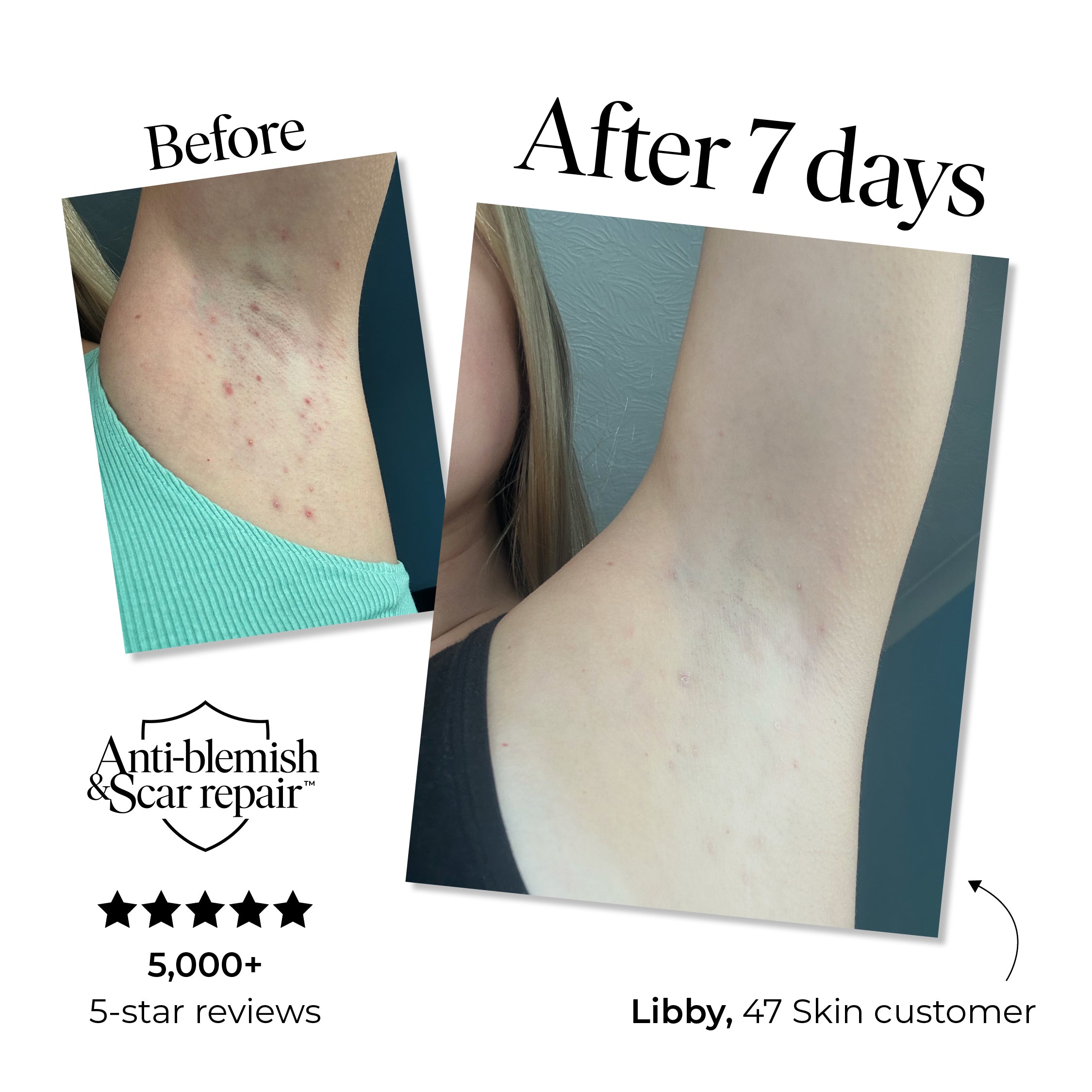 Exfoliating Body Treatment Wash