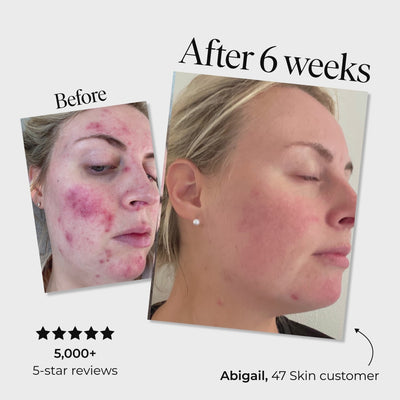 3 Step Treatment Set